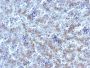 Glypican-3 (GPC3) (Hepatocellular Carcinoma Marker), 1mg/mL