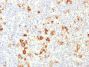 CD15 / FUT4 (Reed-Sternberg Cell Marker), 1mg/mL
