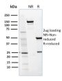 CD36 (Platelet & Microvessel Marker)(GPIIIb/1654), 1mg/mL