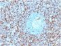 Annexin A1 / (Hairy Cell Leukemia Marker)(ANXA1/1671), 1mg/mL