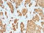 S100B (Astrocyte and Melanoma Marker) (S100B/1706R), 1mg/mL