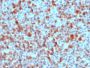 S100B (Astrocyte and Melanoma Marker), 1mg/mL