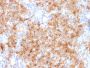 Chromogranin A / CHGA (Neuroendocrine Marker), 1mg/mL