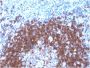 CD79a (B-Cell Marker)(IGA/1790R), 1mg/mL