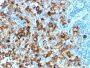 gp100 / Melanosome / PMEL17 / SILV (Melanoma Marker) (PMEL/1825R), 1mg/mL