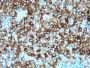 gp100 / Melanosome / PMEL17 / SILV (Melanoma Marker)(N/A), 1mg/mL