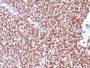 NKX2.2 (Neuroendocrine & Ewing s Sarcoma Marker) (rNX2/294), 1mg/mL