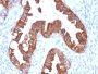 Cytokeratin 7 (Glandular and Transitional Epithelial Marker) (rOV-TL12/30), 1mg/mL