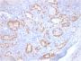 TTF-1 / NKX2.1 (Thyroid & Lung Epithelial Marker)(rNX2.1/690), 1mg/mL