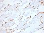 TTF-1 / NKX2.1 (Thyroid & Lung Epithelial Marker)(NX2.1/1855R), 1mg/mL
