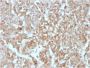 DOG-1 / TMEM16A (Gastrointestinal Stromal Tumor Marker)(rDG1/447), 1mg/mL