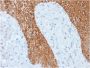 Cytokeratin, Multi (Epithelial Marker)(KRT/1877R), 1mg/mL