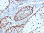 Nucleophosmin (Acute Myeloid Leukemia Marker)(NPM1/1902), 1mg/mL