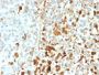 Vimentin (Mesenchymal Cell Marker)(VIM/1937R), 1mg/mL