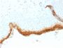 Filaggrin (Keratinocyte Differentiation Marker)(rFLG/1561), 1mg/mL