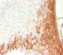 Cytokeratin 10 (Suprabasal Epithelial Marker)(rKRT10/1275), 1mg/mL