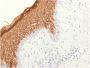 Cytokeratin 10 (Suprabasal Epithelial Marker)(KRT10/1948R), 1mg/mL
