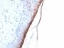 Filaggrin (Keratinocyte Differentiation Marker)(FLG/1957R), 1mg/mL
