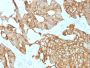 Cytokeratin 19 (KRT19) (Pancreatic Stem Cell Marker)(rKRT19/800), 1mg/mL