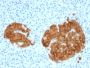 GAD2 / GAD65 (GABAergic Neuronal Marker)(GAD2/1960), 1mg/mL