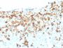 NGF-Receptor (p75) / CD271 (Soft Tissue Tumor Marker)(NGFR/1964), 1mg/mL