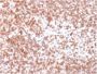 CD45 / LCA (B-Cell Marker)(PTPRC/1975R), 1mg/mL