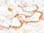 Elastin (ELN) (Marker of Arterial Stiffness and Atherosclerosis)(ELN/1981), 1mg/mL