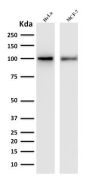 ENAH / MENA (Actin Regulator)(ENAH/1988), 1mg/mL