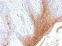 Cytokeratin 10 (KRT10) (Suprabasal Epithelial Marker)(KRT10/1990R), 1mg/mL
