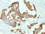 Cytokeratin 20 (KRT20) (Colorectal Epithelial Marker)(KRT20/1992), 1mg/mL