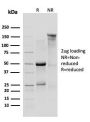 IL-10R1, Mouse (Interleukin-10 Receptor 1) (CD210)(1B1.3a), 1mg/mL