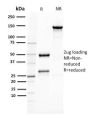 gp100 / Melanosome / PMEL17 / SILV (Melanoma Marker) (PMEL/2037), 1mg/mL