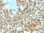gp100 / Melanosome / PMEL17 / SILV (Melanoma Marker) (PMEL/2039), 1mg/mL