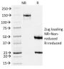gp100 / Melanosome / PMEL17 / SILV (Melanoma Marker) (PMEL/2039), 1mg/mL