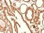 EpCAM / CD326 (Epithelial Marker) (EGP40/2041R), 1mg/mL