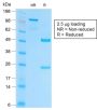 EpCAM / CD326 (Epithelial Marker) (EGP40/2041R), 1mg/mL