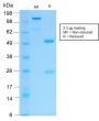 Cytokeratin 16 (KRT16) (Suprabasal Keratinocyte Marker) (KRT16/2043R), 1mg/mL