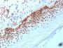 Nucleophosmin (Acute Myeloid Leukemia Marker) (NA24), 1mg/mL