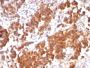 TNFS15 / VEGI (Vascular Endothelial Growth Inhibitor) (rVEGI/1283), 1mg/mL