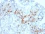 CD103 / Integrin alpha E (T-Cell Lymphoma & Hairy Cell Leukemia Marker) (ITGAE/2063), 1mg/mL