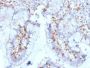 CD103 / Integrin alpha E (T-Cell Lymphoma & Hairy Cell Leukemia Marker) (ITGAE/2063), 1mg/mL