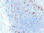 CD103 / Integrin alpha E (T-Cell Lymphoma & Hairy Cell Leukemia Marker) (ITGAE/2063), 1mg/mL