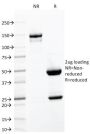 CD103 / Integrin alpha E (T-Cell Lymphoma & Hairy Cell Leukemia Marker) (ITGAE/2063), 1mg/mL