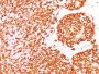 CD45 / LCA (B-Cell Marker)(rPTPRC/1460), 1mg/mL