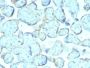 Superoxide Dismutase 1 (SOD1) (Antioxidant Enzyme) (SOD1/2089), 1mg/mL