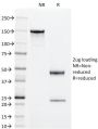 Superoxide Dismutase 1 (SOD1) (Antioxidant Enzyme) (SOD1/2089), 1mg/mL