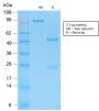 Cytokeratin 15 (Esophageal Squamous Cell Carcinoma Marker) (KRT15/2103R), 1mg/mL