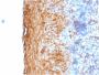 Involucrin (Squamous Cell Terminal Differentiation Marker)(IVRN/2113R), 1mg/mL