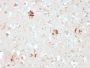 Ubiquitin (Autophagy Marker) (UBB/2122), 1mg/mL