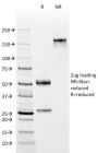 OCT-2 (POU2F2) (B-Cell Marker) (OCT2/2137), 1mg/mL